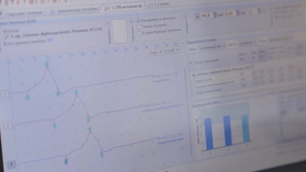 Computermonitor mit medizinischen Indikationen. — Stockvideo