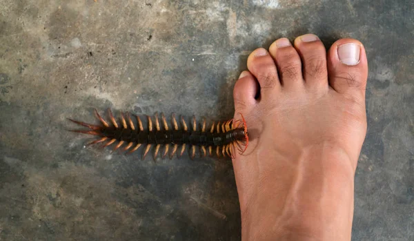 People were bitten by a centipede on their feet — Stock Photo, Image