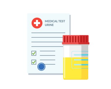 Plastik kavanoz idrar testi ve sonuçları verileri ve onaylı onay işareti vektör illüstrasyon ile tıbbi form listesi. İdrar tahlili ile düz klinik kontrol listesi belgesi. Sigorta veya ilaç hizmeti konsepti