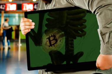 Görünüm bitcoin akciğerlere incelemek için alınan röntgen filmi