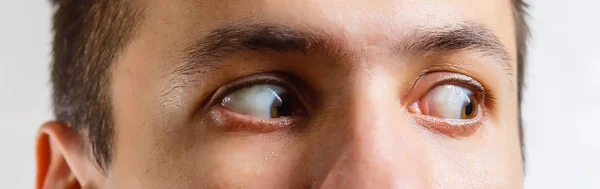 Human Eyes Male Sight — Stock Photo, Image