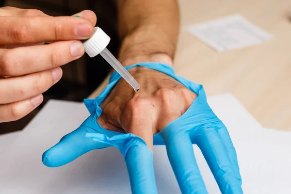 Vista Perto Das Mãos Masculinas Usando Pipeta Laboratório — Fotografia de Stock