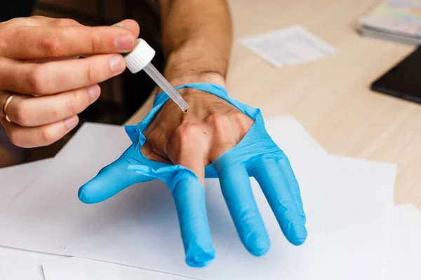 Vista Perto Das Mãos Masculinas Usando Pipeta Laboratório — Fotografia de Stock