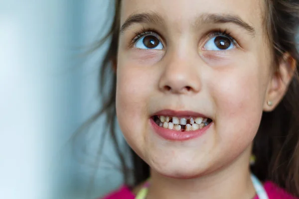 Bambina Shirt Rosa Che Mostra Gli Spazi Tra Denti — Foto Stock
