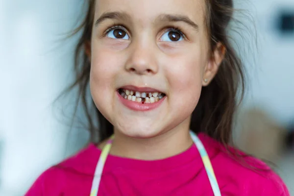 Bambina Shirt Rosa Che Mostra Gli Spazi Tra Denti — Foto Stock