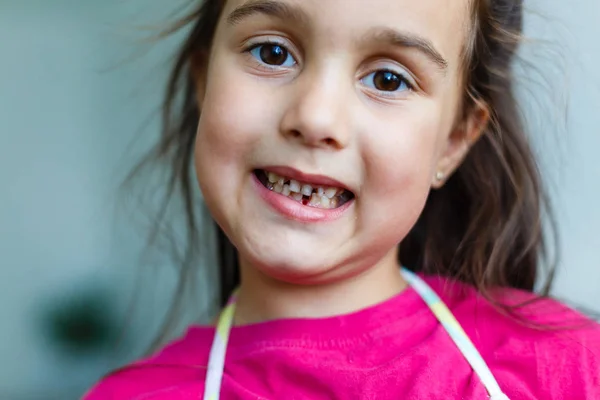 Mała Dziewczynka Różowym Koszulce Pokazująca Przerwy Zębów — Zdjęcie stockowe