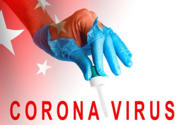 Doktor eldivenli, 2019 nCoV laboratuvarda analiz ediyor. Roman Coronavirus Wuhan, Çin kökenlidir..