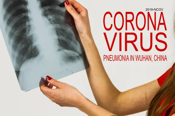 전염병 진단과 중국에서 바이러스성 폐렴을 일으키는 코로나 바이러스 2019 Ncov — 스톡 사진