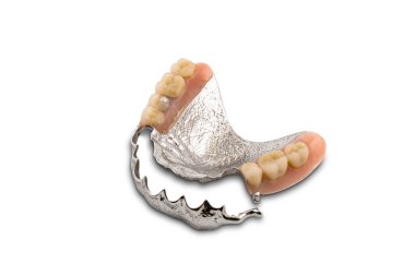 Kısmi metal çıkarılabilir takma diş, kırpma yolu ile beyaz arkaplanda izole edildi.