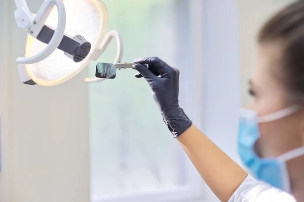 Primer plano de la radiografía dental de los dientes en las manos del médico dentista — Foto de Stock