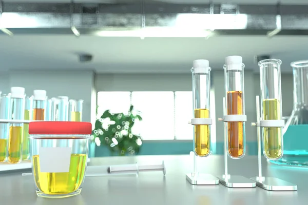 Test Échantillon Urine Pour Les Oxalates Calcium Éprouvettes Laboratoire Dans — Photo