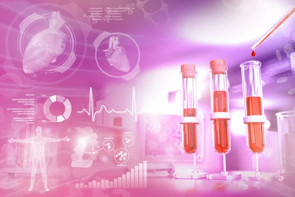 Kirlilik kliniğinde kanıtlar - kırmızı hücre dağılımı için kan geni testi veya potasyum, yaratıcı gradyan örtülü tıbbi 3D çizim