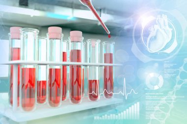 Kirlilik ofisindeki test tüpleri - bazofiller veya trigliseritler için kan örneği analizi, yaratıcı kaplamalı tıbbi 3D illüstrasyon
