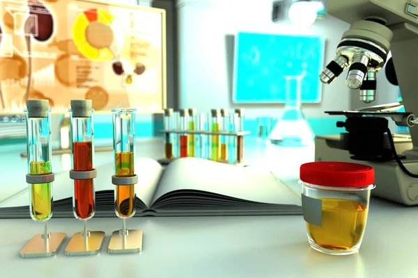 Prove Laboratorio Clinica Chimica Test Qualità Delle Urine Bilirubina Ossalati — Foto Stock