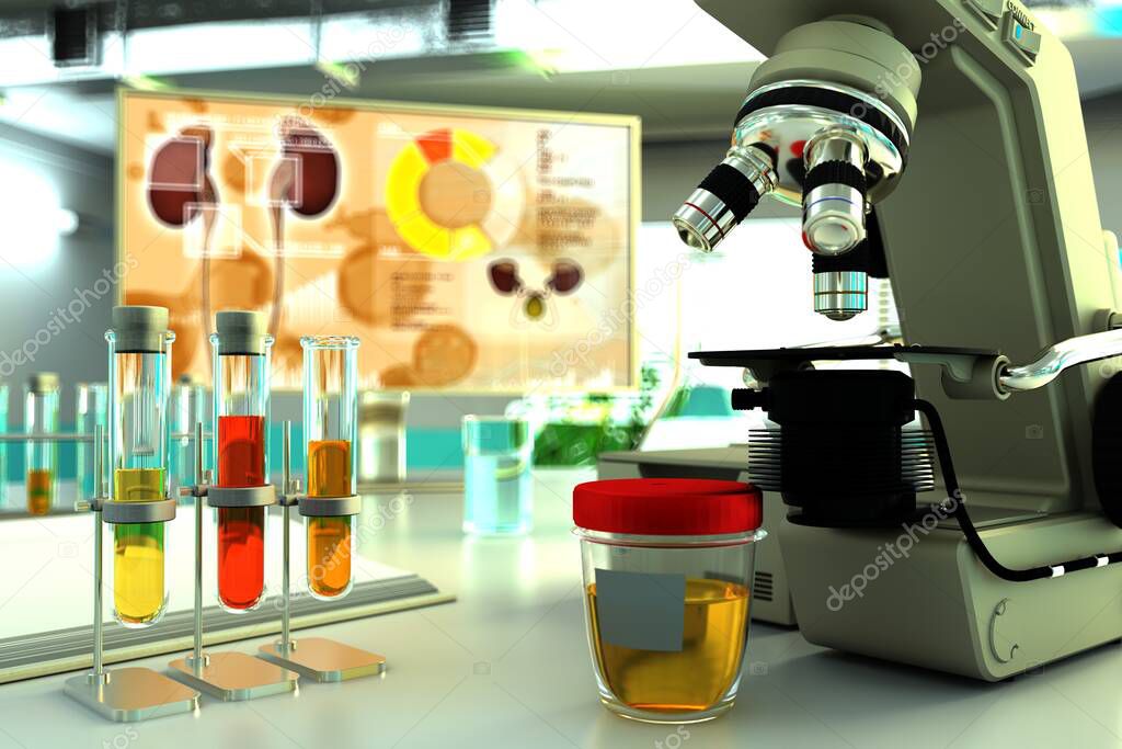 lab test tubes in scientific clinic - urine quality test for glucose or leucine, medical 3D illustration