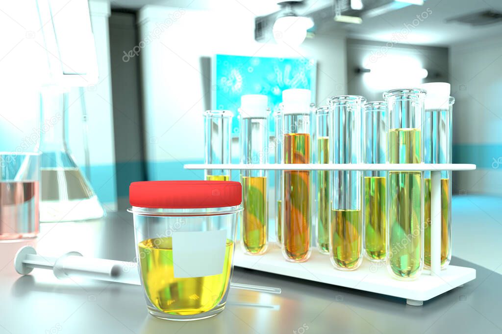 Urine sample test for parasites or blood in urine hematuria - laboratory test-tubes in modern pharmaceutical clinic, medical 3D illustration