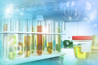 Belirli yerçekimi veya biçimsiz fosfatlar için idrar örneği testi - modern biyokimya araştırma ofisinde test tüpleri, tıbbi 3D illüstrasyon