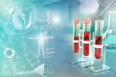 Medical 3D illustration, test-tubes vials in college clinic - blood gene test for amount of platelets or lupus with creative overlay clipart