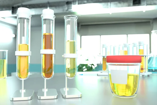 Test Échantillon Urine Pour Gravité Spécifique Grossesse Éprouvettes Laboratoire Dans — Photo