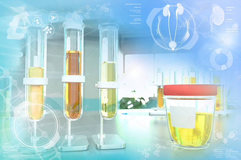Urine sample test for parasites or amorphous phosphates - proofs in modern science university office, medical 3D illustration