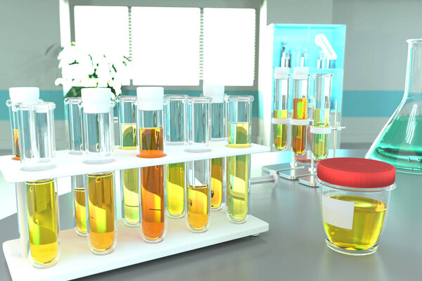 Анализ мочи на лейкоцитарную эстеразу или бактерии - лабораторные пробирки в современном медицинском кабинете, медицинская 3D иллюстрация
