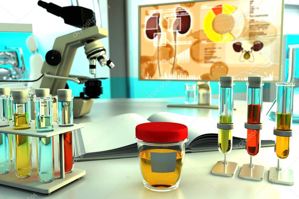 lab test tubes in biochemistry clinic - urine quality test for ph or blood in urine hematuria, medical 3D illustration