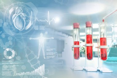 Medical 3D illustration, test-tubes vials in college facility - blood dna test for calcium or lupus with creative overlay clipart