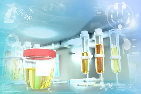 Test Échantillon Urine Pour Levure Acide Urique Cristallin Tubes Essai — Photo