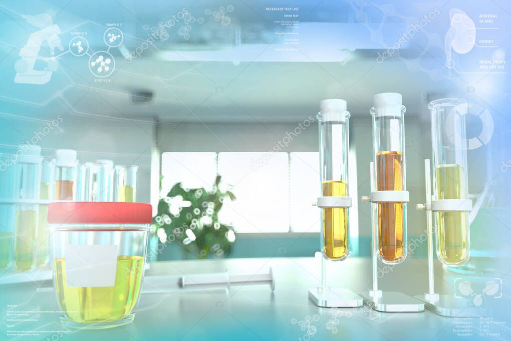 Urine sample test for bilirubin or amorphous urates - test tubes in modern chemistry college clinic, medical 3D illustration