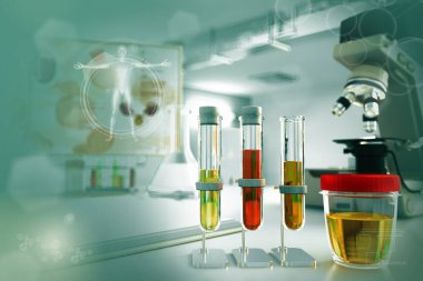 Ketonlar ya da şekilsiz uratlar için idrar testi - modern biyoteknoloji çalışma kliniğinde test tüpleri, tıbbi 3D illüstrasyon