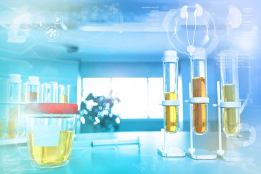 Modern bilim üniversitesi kliniğinde kanıtlar - keton veya enfeksiyon için idrar kalitesi testi, tıbbi 3D illüstrasyon