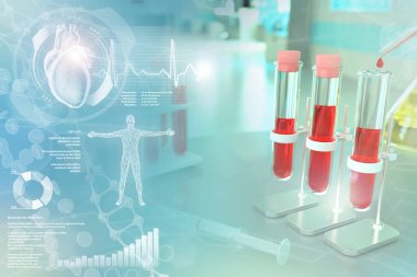 Tıbbi 3D illüstrasyon, üniversite kliniğinde test tüpleri - kan şekeri için oruç tutmak veya yaratıcı kaplamalı AIDS için kan testi