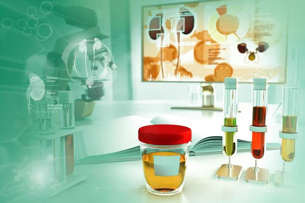 Modern Biyoteknoloji Kolej Kliniğinde Test Tüpleri Lökosit Esteraz Için Idrar — Stok fotoğraf