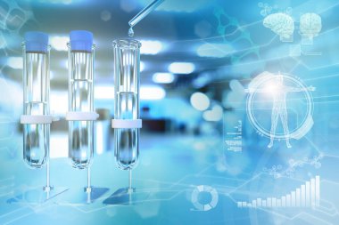 Modern kimya fakültesi kliniğinde laboratuvar test tüpleri - bakteri tasarımı geçmişi için içilebilir su kalitesi testi, tıbbi 3D illüstrasyon