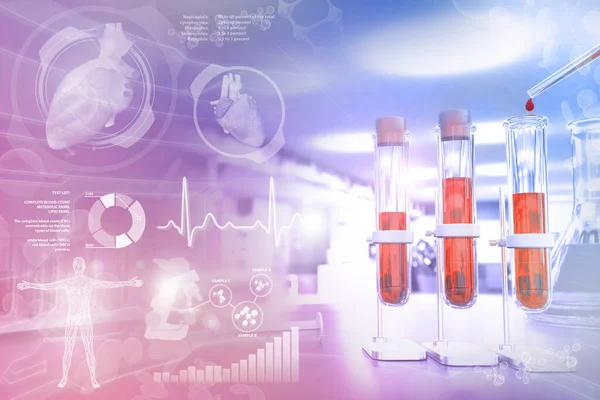 Kimyasal Tesiste Kanıtlar Albümin Kolesterol Için Kan Örneği Dna Testi — Stok fotoğraf