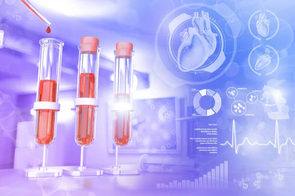 Bilimsel Klinikte Test Tüpleri Protein Veya Anemi Için Kan Geni — Stok fotoğraf