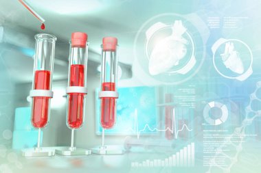 Kimya tesisinde test tüpleri - monosit veya lupus için kan testi, yaratıcı kaplamalı tıbbi 3D illüstrasyon