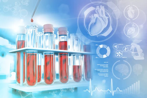 Reageerbuisjes Wetenschappelijke Kliniek Bloedanalyse Basofielen Triglyceriden Medische Illustratie Met Creatief — Stockfoto