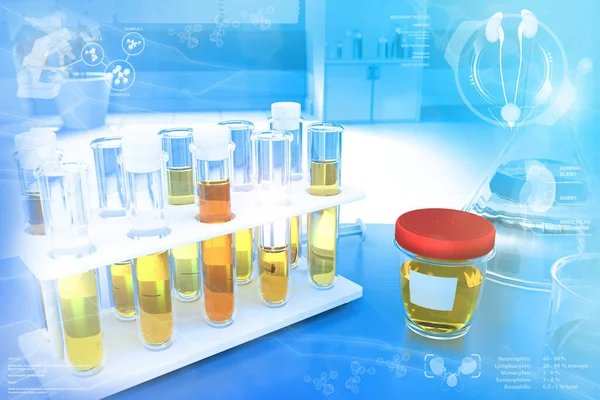 test tubes in modern medical university facility - urine quality test for specific gravity or kidney disease, medical 3D illustration