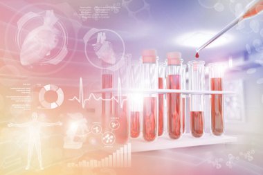Tıbbi 3D illüstrasyon, çalışma odasındaki test tüpleri şişeleri - eozinofil veya lupus için yaratıcı gradyan örtülü kan analizi