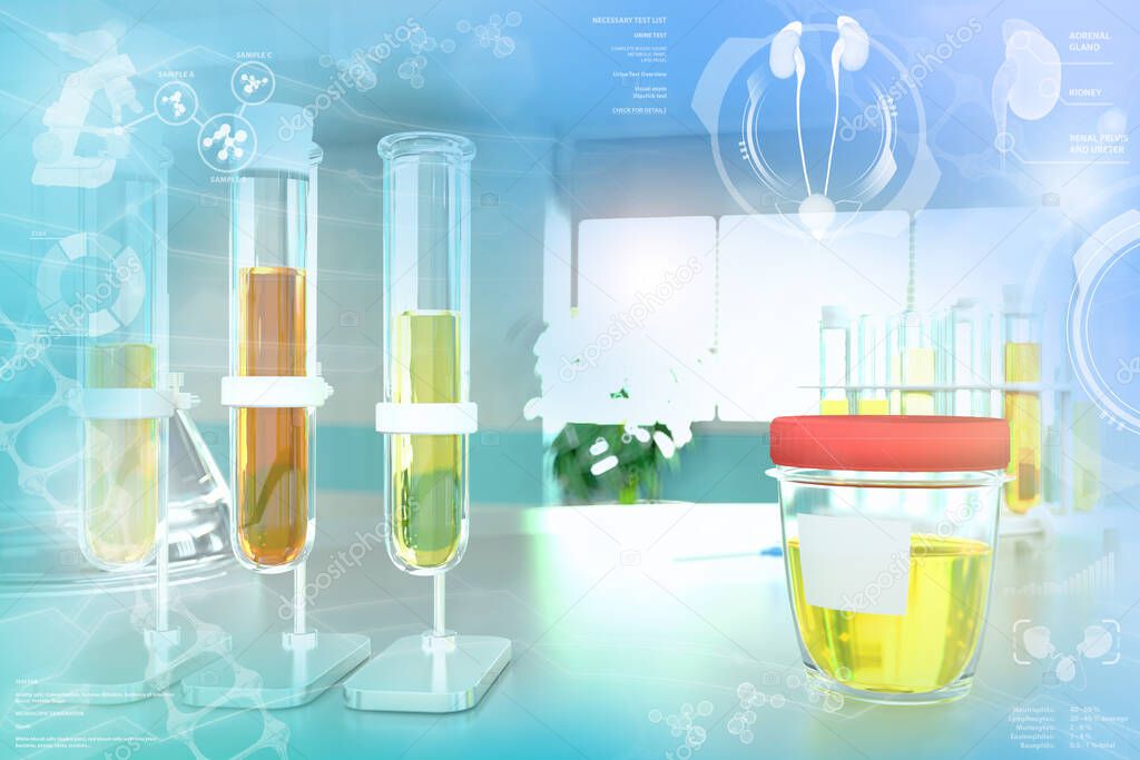 Urine sample test for ph or leucine - test tubes in modern biotechnology study facility, medical 3D illustration