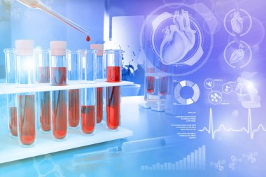 İlaç kliniğinde kanıtlar - monosit ya da kolesterol için kan analizi, yaratıcı gradyan örtülü tıbbi 3D illüstrasyon