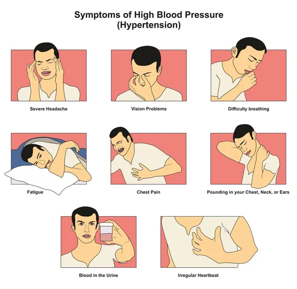 Symptome Von Bluthochdruck Infografisches Diagramm Anzeichen Risiken Einschließlich Müdigkeit Kopfschmerzen — Stockvektor