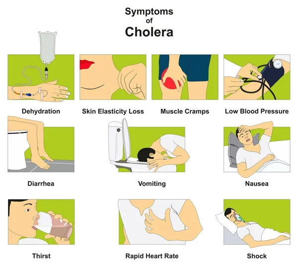 Symptomen Van Cholera Infographic Diagram Tekenen Risico Zoals Uitdroging Huid — Stockvector