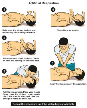 Yapay solunum Infographic diyagramı adım adım poster acil ilk yardım sağlık eğitimi ve sağlık bakımı için bir kurbana sağlayan bir ilk aider gösterilen talimatları ile