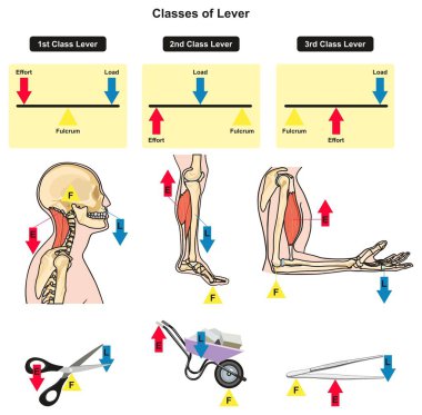 Sınıflar kolu Infographic diyagramının parçaları ve tip dahil dayanak gösterilen yük ve insan vücudu eklem kemikler ve kaslar örnekleri ile çaba her gün Fizik bilim eğitimi için yaşıyor