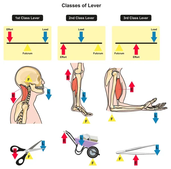 Classes Diagrama Infográfico Alavanca Mostrando Peças Tipos Incluindo Carga Fulcro — Vetor de Stock