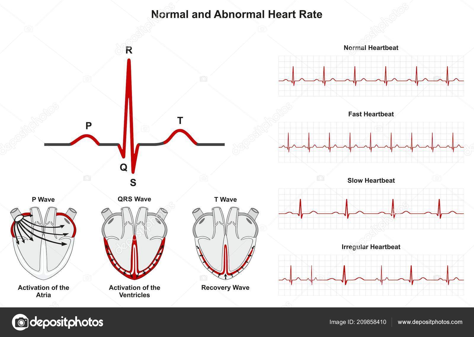 Heart Rate Recovery Chart