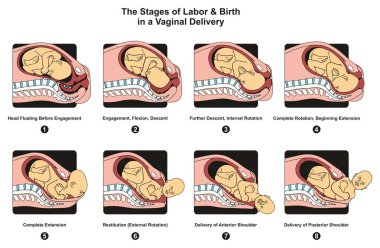 Emek ve Doğum aşamaları nişan iniş iç tam döndürme uzantısı poster tıbbi bilim eğitim ve sağlık için de dahil olmak üzere bir vajinal Doğum Infographic diyagramı
