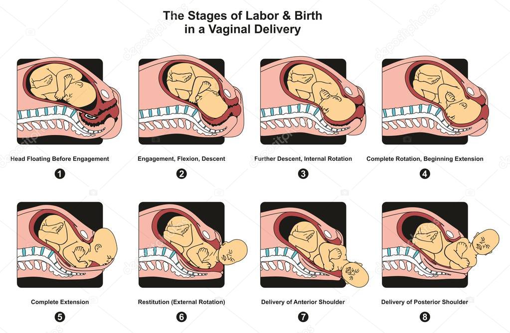 Stages of Labor and Birth in a vaginal delivery infographic diagram including engagement descent internal complete rotation extension poster for medical science education and healthcare